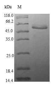 Human EIF2B1 Protein (Recombinant GST, N-terminus)