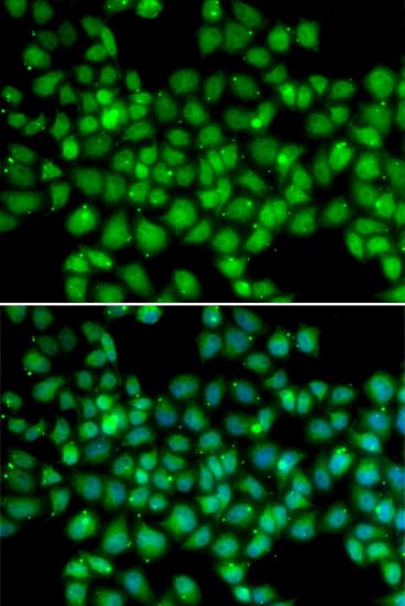 Polyclonal Rabbit anti-Human ARRB2 / Beta Arrestin 2 Antibody (IHC, IF, WB)