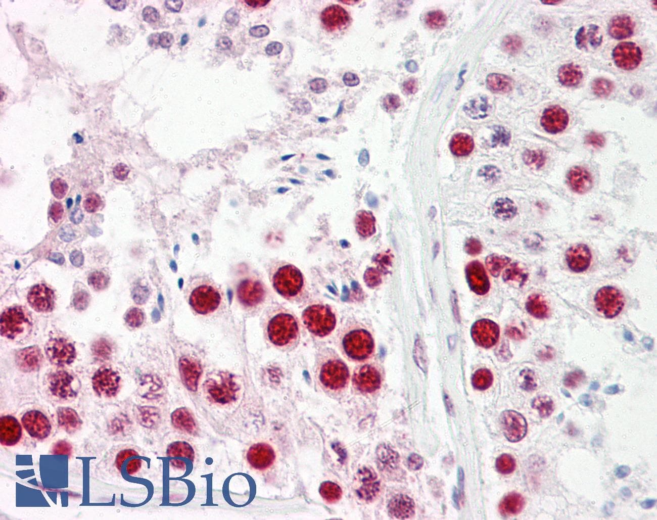 IHC-plus™ SAE2 / UBA2 Antibody (aa591-640)