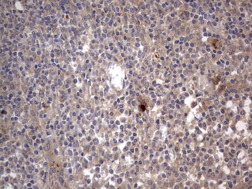 Monoclonal Mouse anti-Human SMPD1 / Acid Sphingomyelinase Antibody (clone OTI3H7, aa62-341, IHC, WB)