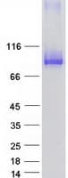 Human HCCS1 / VPS53 Protein (Recombinant Myc-DDK (Flag))