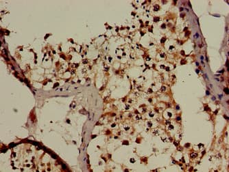 c-CBL Antibody
