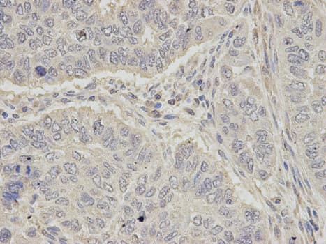IHC-plus™ OGT / O-GLCNAC Antibody
