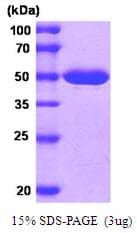 Human MAT2A Protein (Recombinant His)