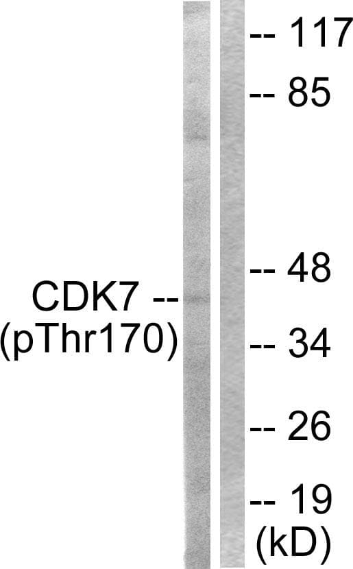 CDK7 Antibody (phospho-Thr170)