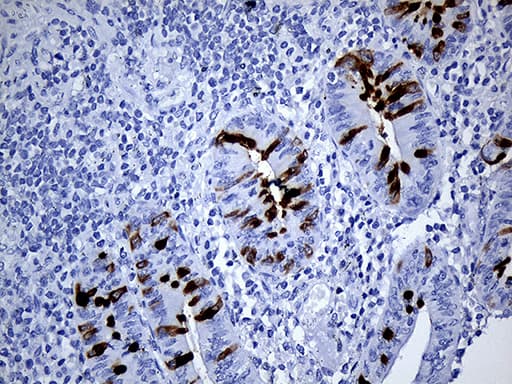 Monoclonal Mouse anti-Human TFF3 / Trefoil Factor 3 Antibody (clone OTI4D10, aa72-130, IHC, WB)