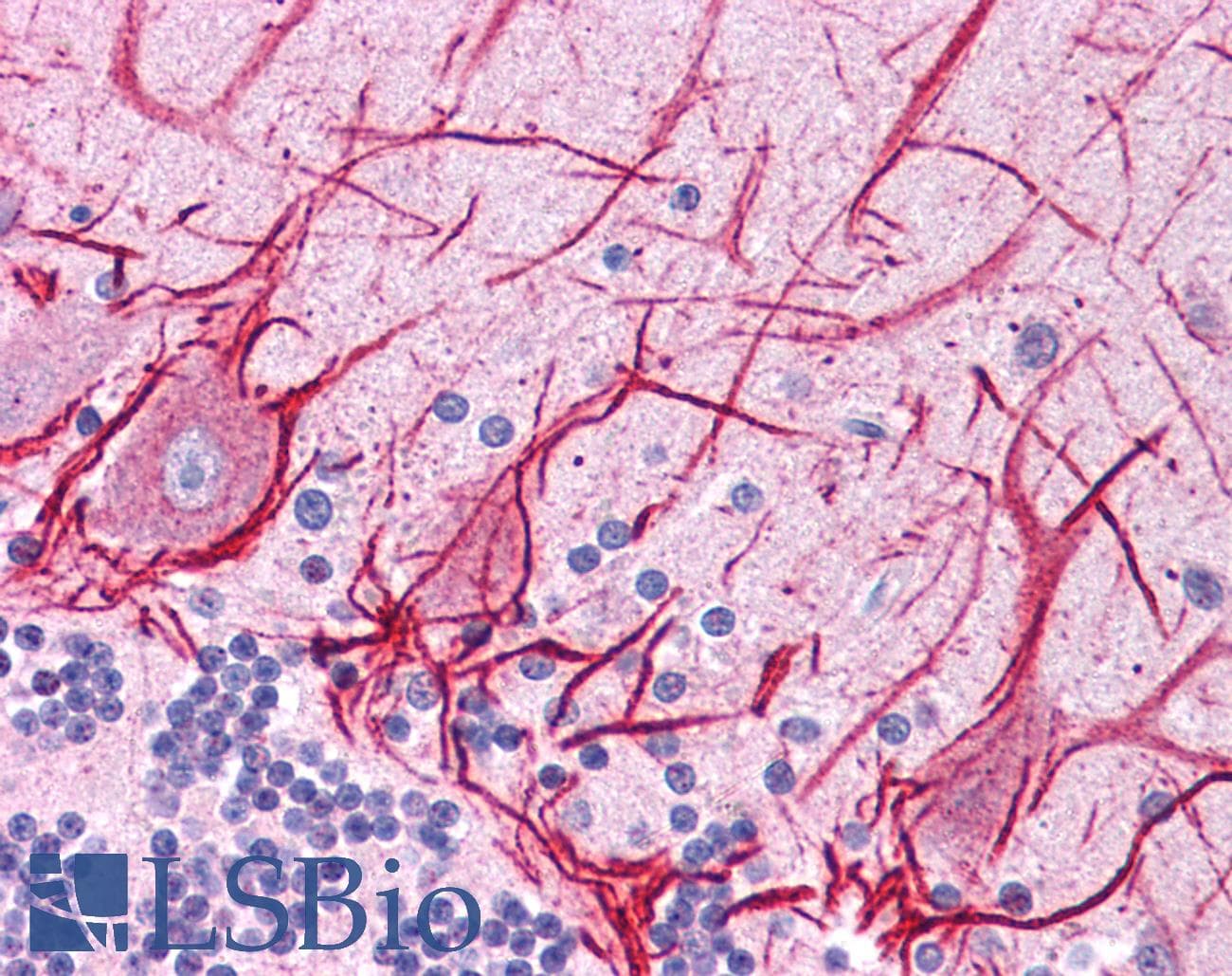 Polyclonal Rabbit anti-Human APOB / Apolipoprotein B Antibody (aa4031-4080, IHC, WB)