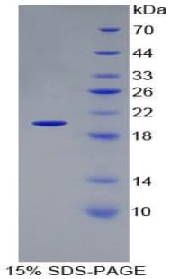 Rat MMP9 / Gelatinase B Protein (Recombinant His)