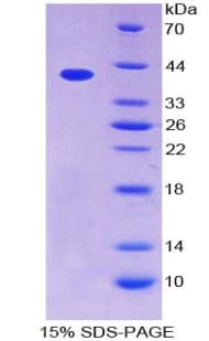 Human CCL4L1 Protein (Recombinant His-GST)