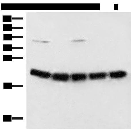 ARF5 Antibody