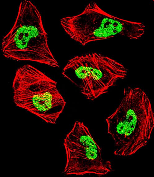 PathPlus™ TDP-43 / TARDBP Antibody (aa1-30)