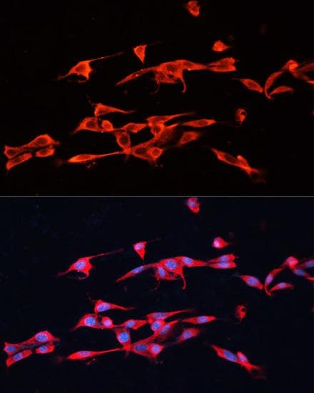 GPC3 / Glypican 3 Antibody