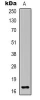 Polyclonal Rabbit anti-Human EPGN / Epigen Antibody (Internal, WB)