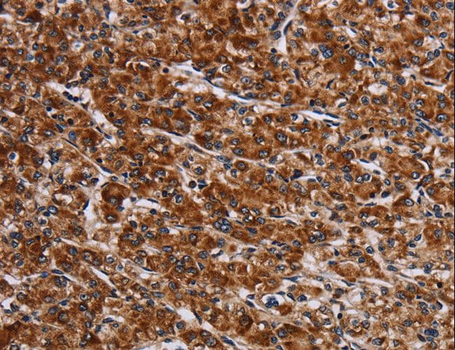 Polyclonal Rabbit anti-Human LRRC15 Antibody (IHC)