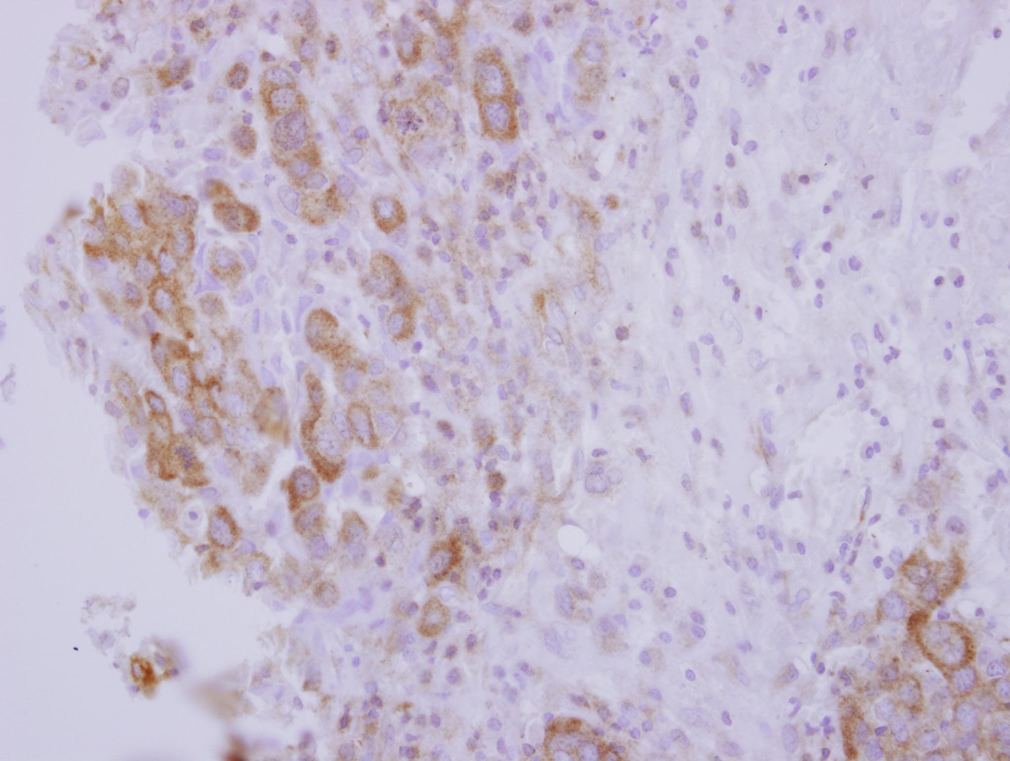 OSBPL5 Antibody (Internal)