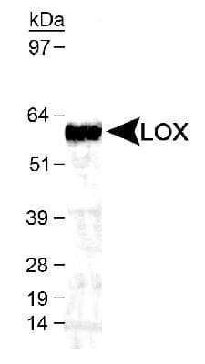 LOX / Lysyl Oxidase Antibody (aa300-400)