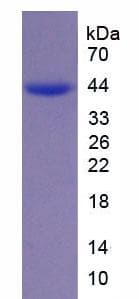 Human UGT2B7 Protein (Recombinant His, N-Terminal)