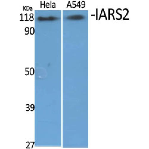 IARS2 Antibody (40-120 aa, N-terminal)