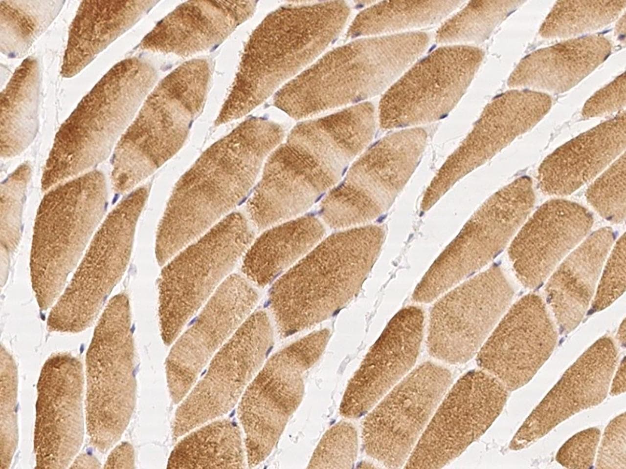 Polyclonal Rabbit anti-Human GHITM Antibody (IHC)