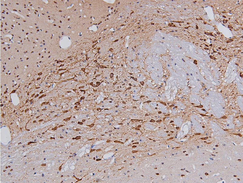 TH / Tyrosine Hydroxylase Antibody (phospho-Ser40)