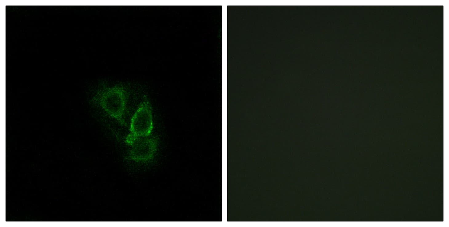 RRAD Antibody (aa41-90)