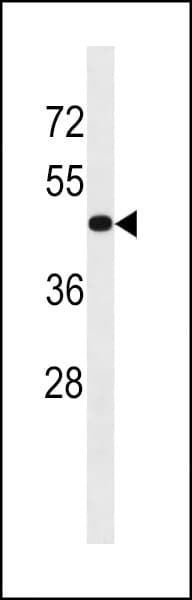 Polyclonal Rabbit anti-Human TGFBR1 / ALK5 Antibody (aa145-172, WB)