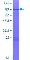 Human ATAC1 / ZZZ3 Protein (Recombinant GST)