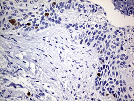 TOP2A / Topoisomerase II Alpha Antibody (aa1100-1531, clone OTI19D4)