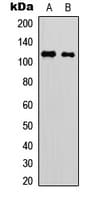 MPRIP / RIP3 Antibody (Internal)