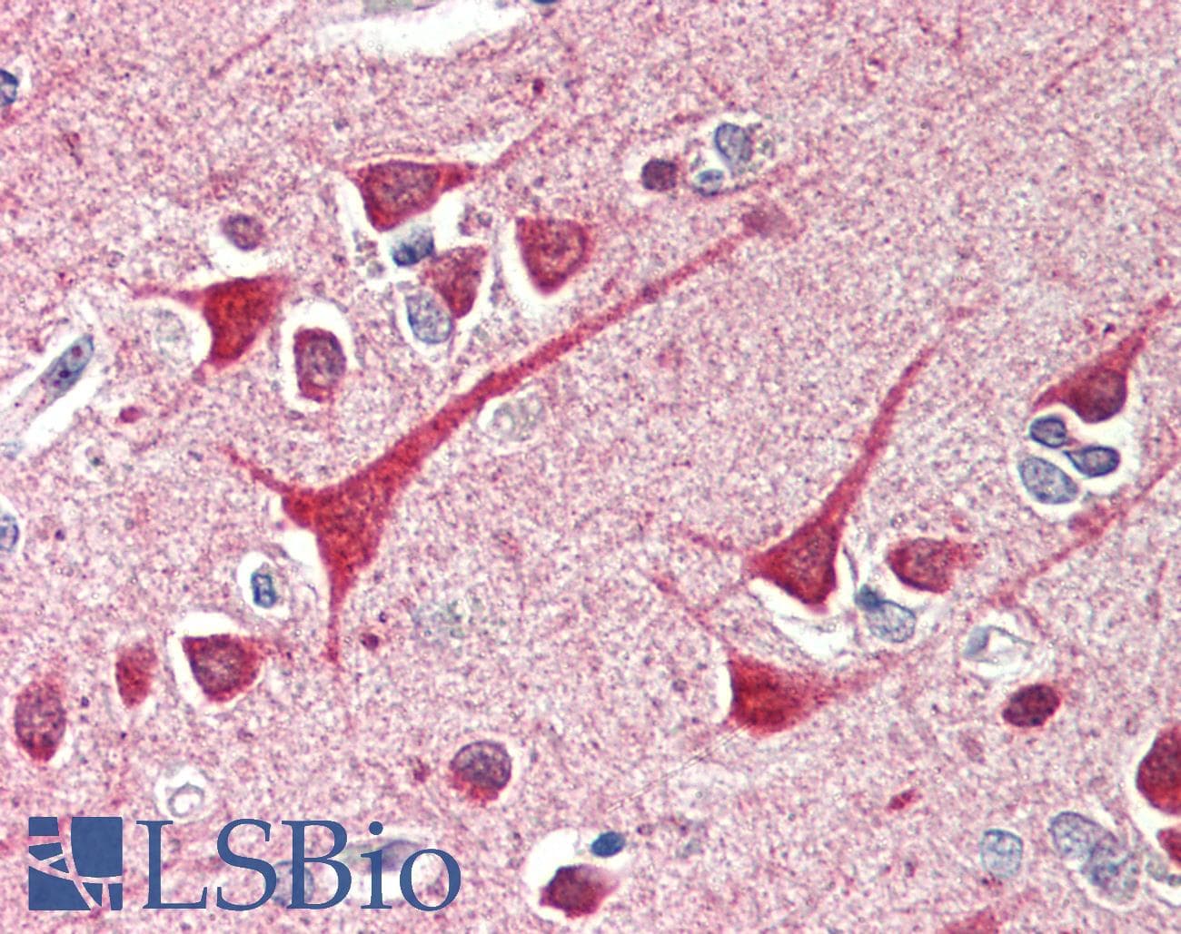 IHC-plus™ CIDEB Antibody