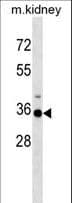 HOXA3 Antibody (aa416-443)