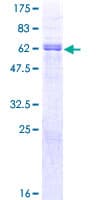 Human PAX9 Protein (Recombinant GST)