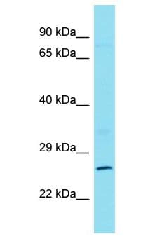 CXorf23 Antibody (aa139-188)