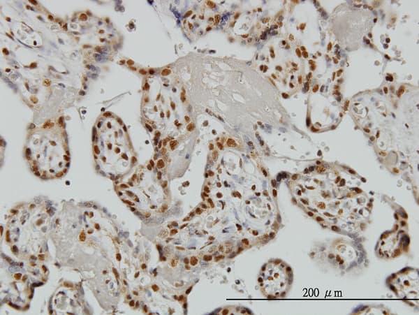 ZRANB2 / ZNF265 Antibody (clone 1D10)