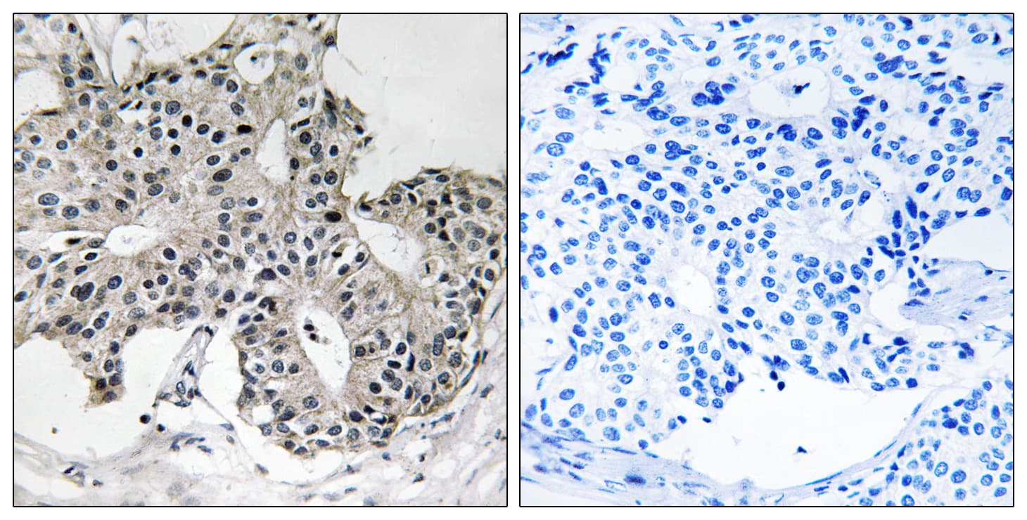Polyclonal Rabbit anti-Human PEX2 / PAF-1 Antibody (aa1-50, IHC, WB)