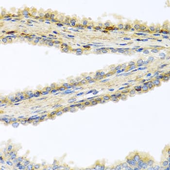 GPLD1 / GPIPLD Antibody
