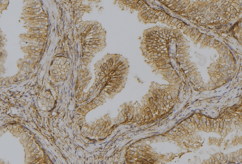 Polyclonal Rabbit anti-Human DAPK1 / DAP Kinase Antibody (IHC, WB)