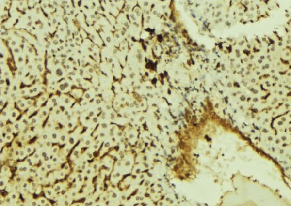 KHDRBS1 / SAM68 Antibody