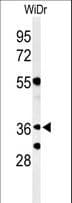 Polyclonal Rabbit anti-Human NSMCE4A / NSE4A Antibody (aa29-57, WB)