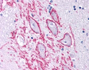 TACR1 / NK1R Antibody (N-Terminus, DY488)