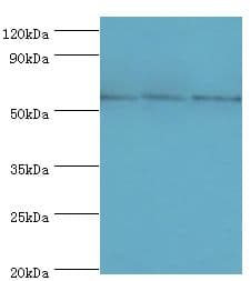 Polyclonal Rabbit anti-Human TBL1XR1 / TBLR1 Antibody (aa1-180, IHC, WB)