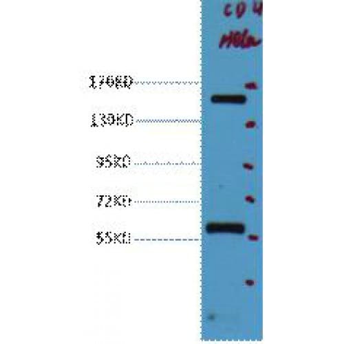 CD45 / LCA Antibody (clone 12A9)
