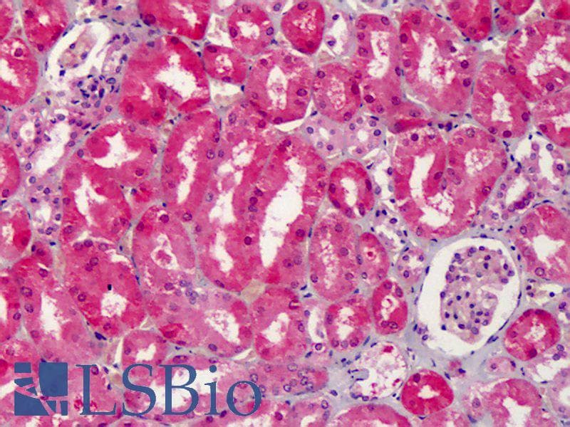 PathPlus™ PTGS2 / COX2 / COX-2 Antibody (aa550-600)