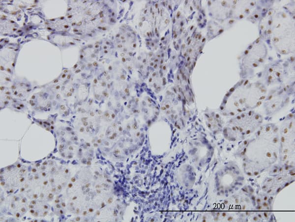 Monoclonal Mouse anti-Human CDC25C Antibody (clone 3B11, IHC, WB)