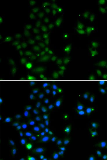GCM1 Antibody