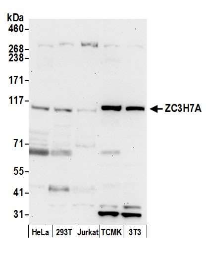 ZC3H7A Antibody (aa921-971)