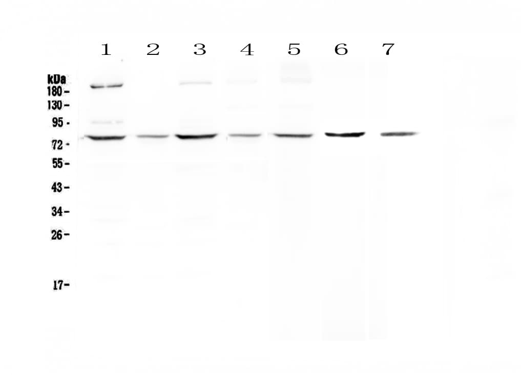 Polyclonal Rabbit anti-Human MST1 Antibody (WB)
