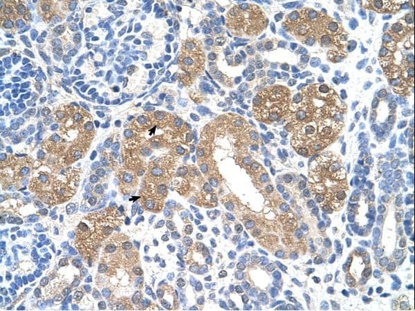 Polyclonal Rabbit anti-Human FAH Antibody (FITC, aa311-360, IHC, WB)