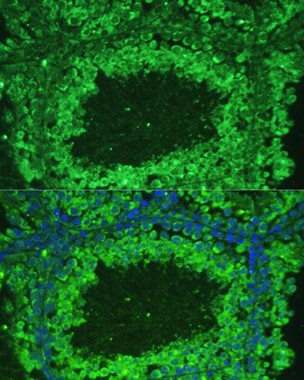Polyclonal Rabbit anti-Human ASZ1 / Orf3 Antibody (IHC, IF)