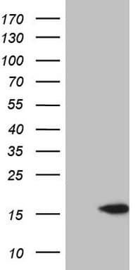 CETN3 Antibody (clone OTI3B5)